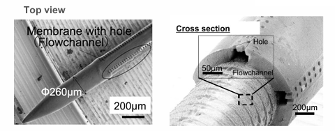 皮膚微小還流システム
