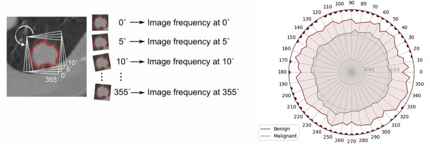医療画像の解析方法・プログラム