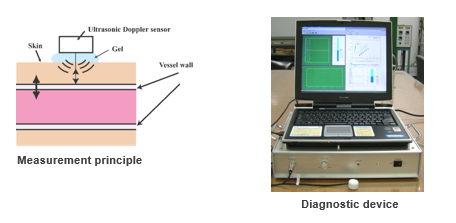 Diagnostic device for Arteriosclerosis and Aneurysm