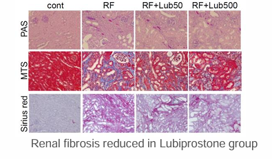 Renal function improving agent