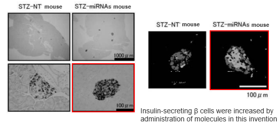 Nucleic acid molecules that increase insulin-secreting beta cells