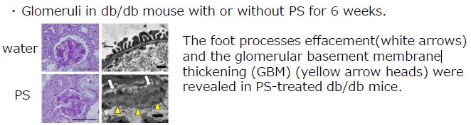 Risk Marker for Diabetic Kidney Disease