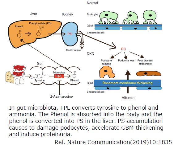 Risk Marker for Diabetic Kidney Disease