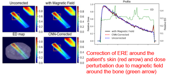 Quick dose calculation algorithm under magnetic field using deep learning