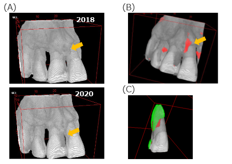 3D image processing program