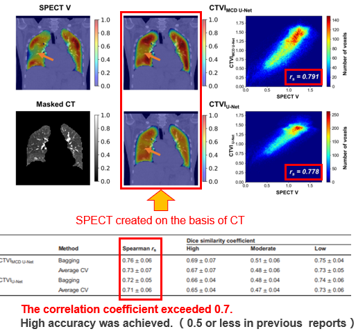 Method for predicting lung function