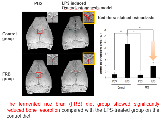 Inhibitor of bone resorption