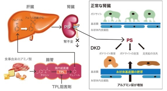 尿毒症物質3分画研究検査サービス